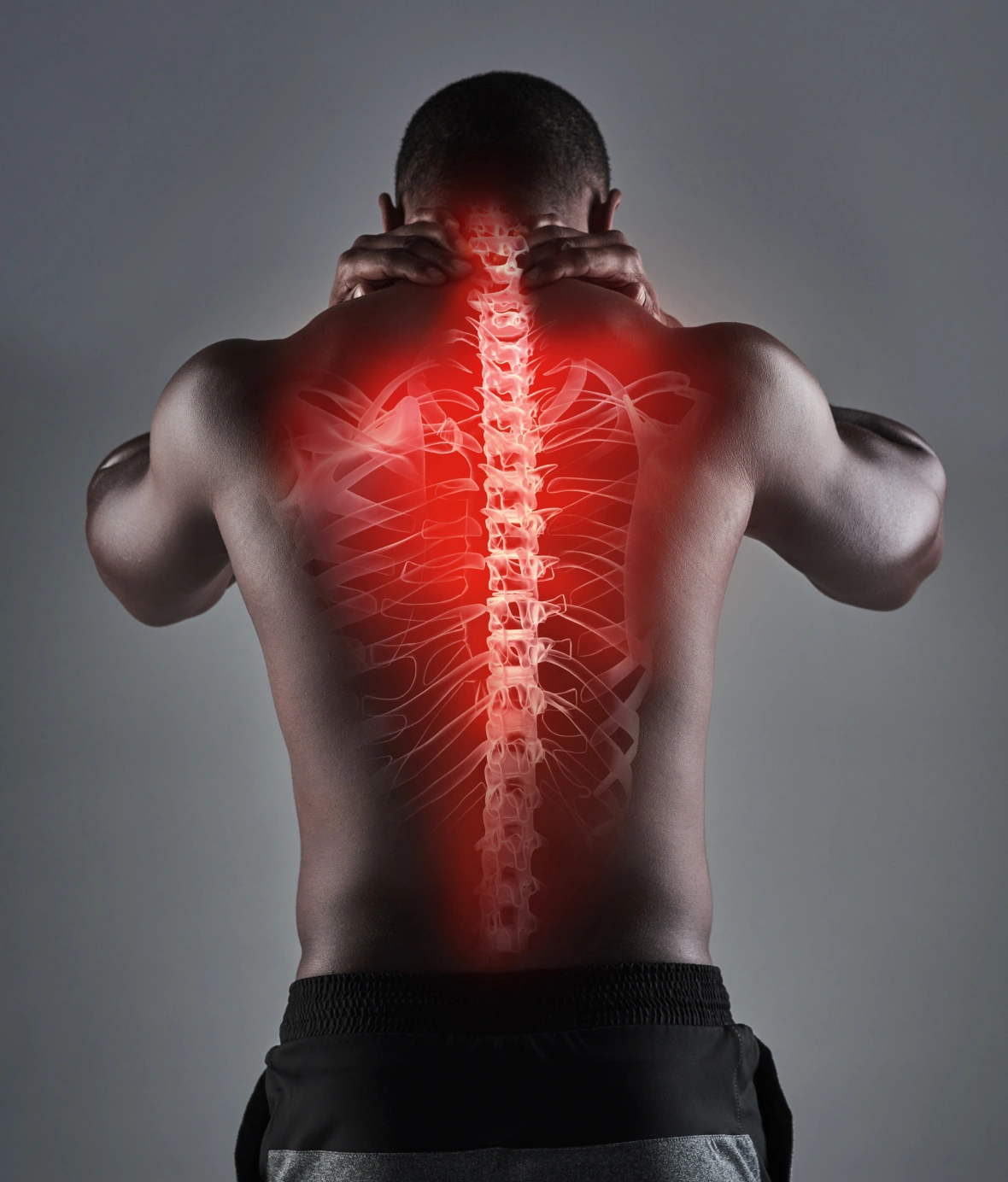 Effective Spinal Stenosis