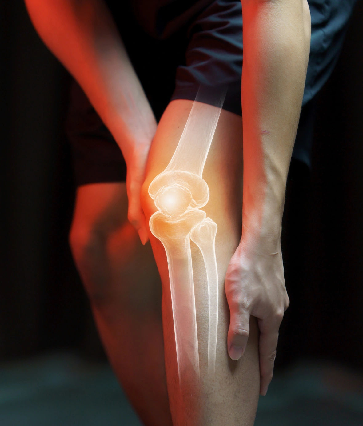 Signs & Symptoms of an ACL Tear