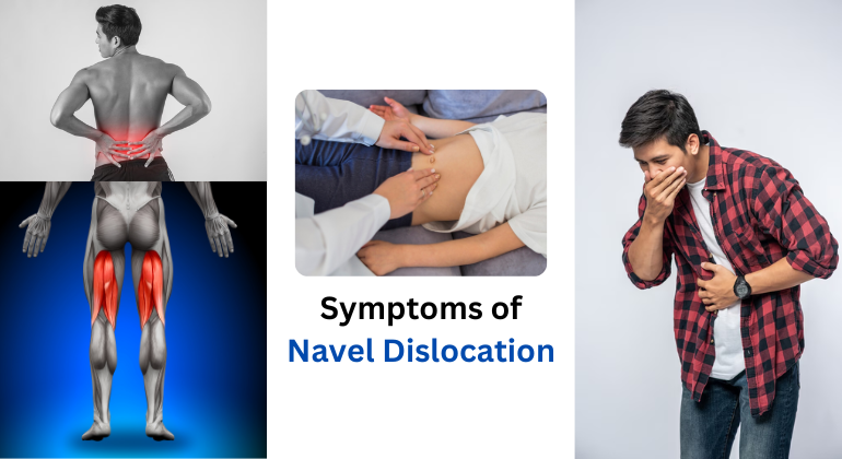 Collage showing various symptoms of navel dislocation: a man with lower back and leg pain, a clinical examination of the abdomen, and a man feeling nauseous and clutching his stomach — all indicating signs of navel misalignment.