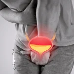 Overactive Bladder Why You Suddenly Need to Rush to the Toilet